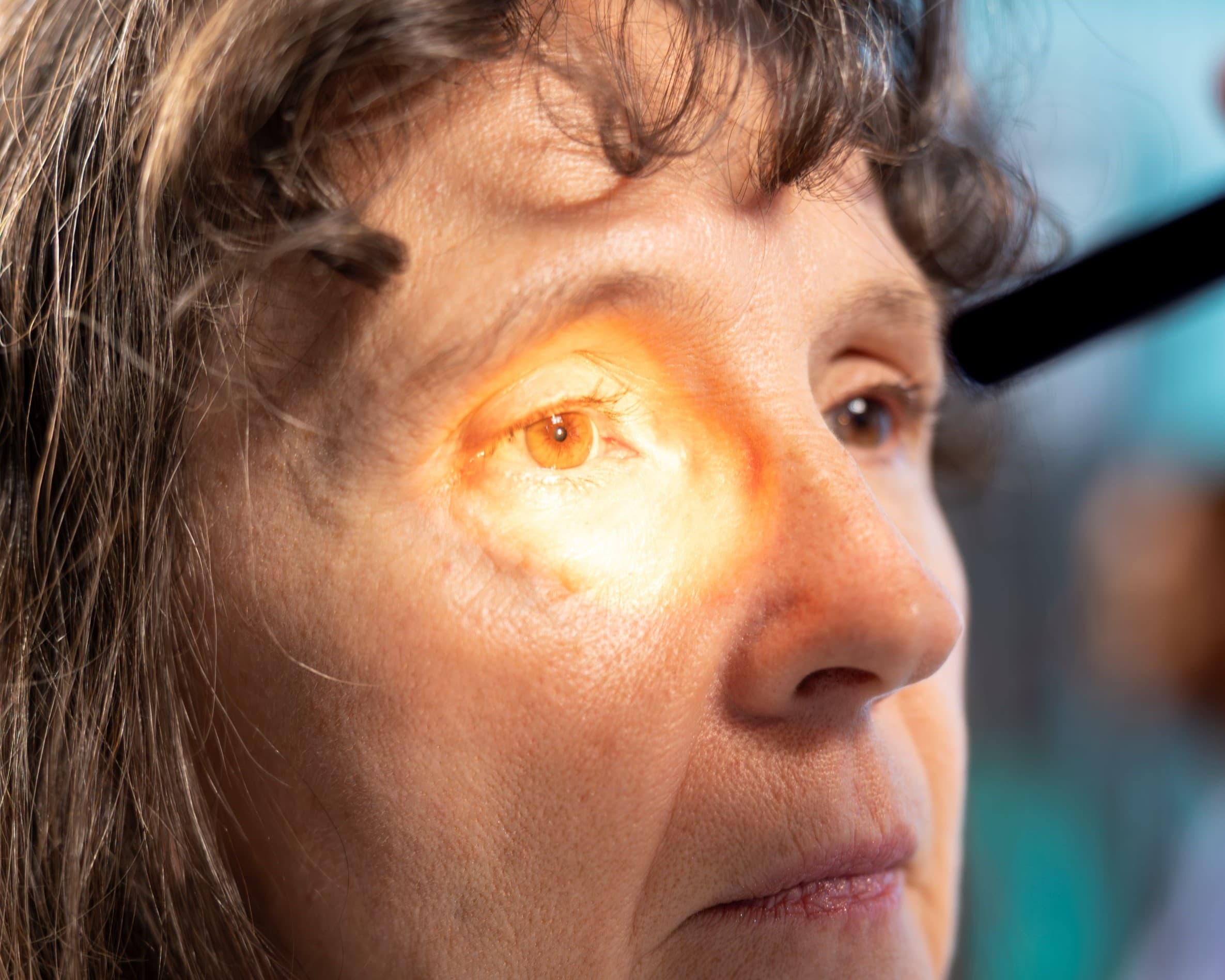 SLT Laser για Γλαύκωμα: Πλήρης Οδηγός Θεραπείας Χωρίς Χειρουργείο